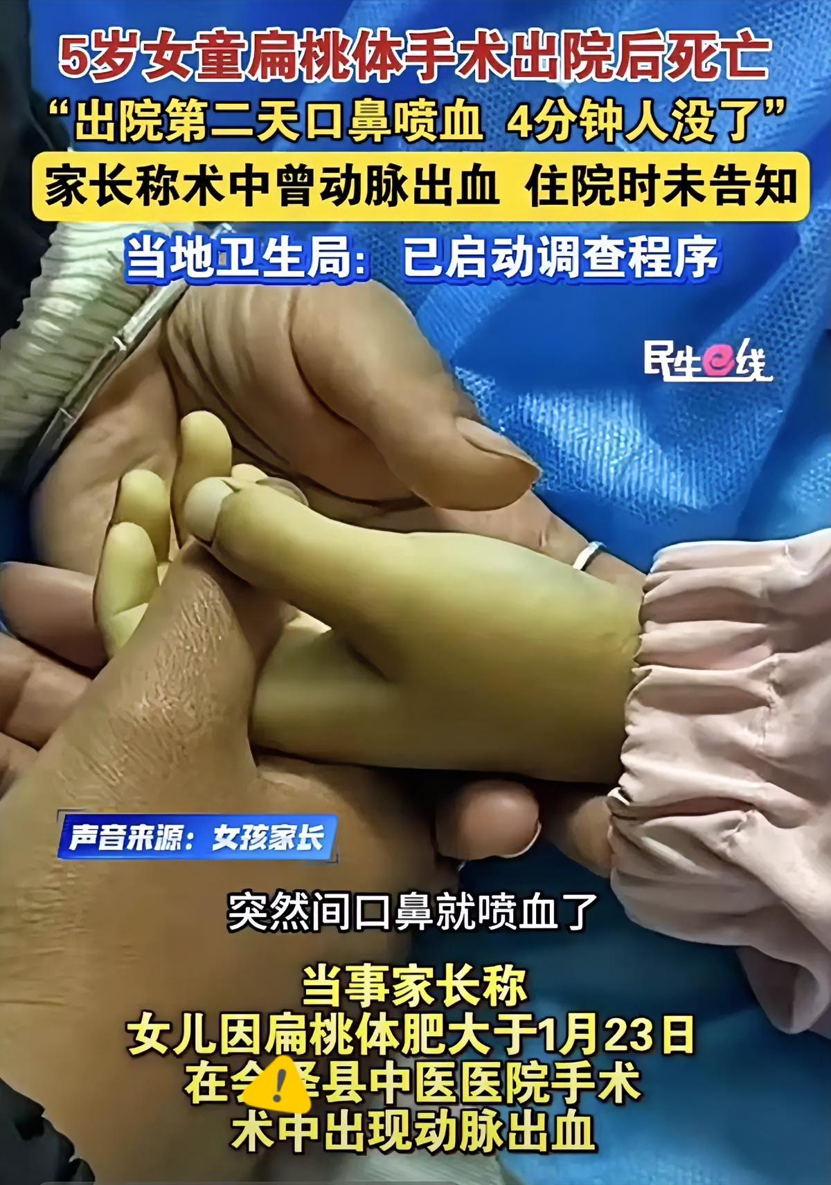 5岁女童扁桃体术后离世，

4分钟口鼻喷血没了，家长怒了！
 
云南会泽县一名5