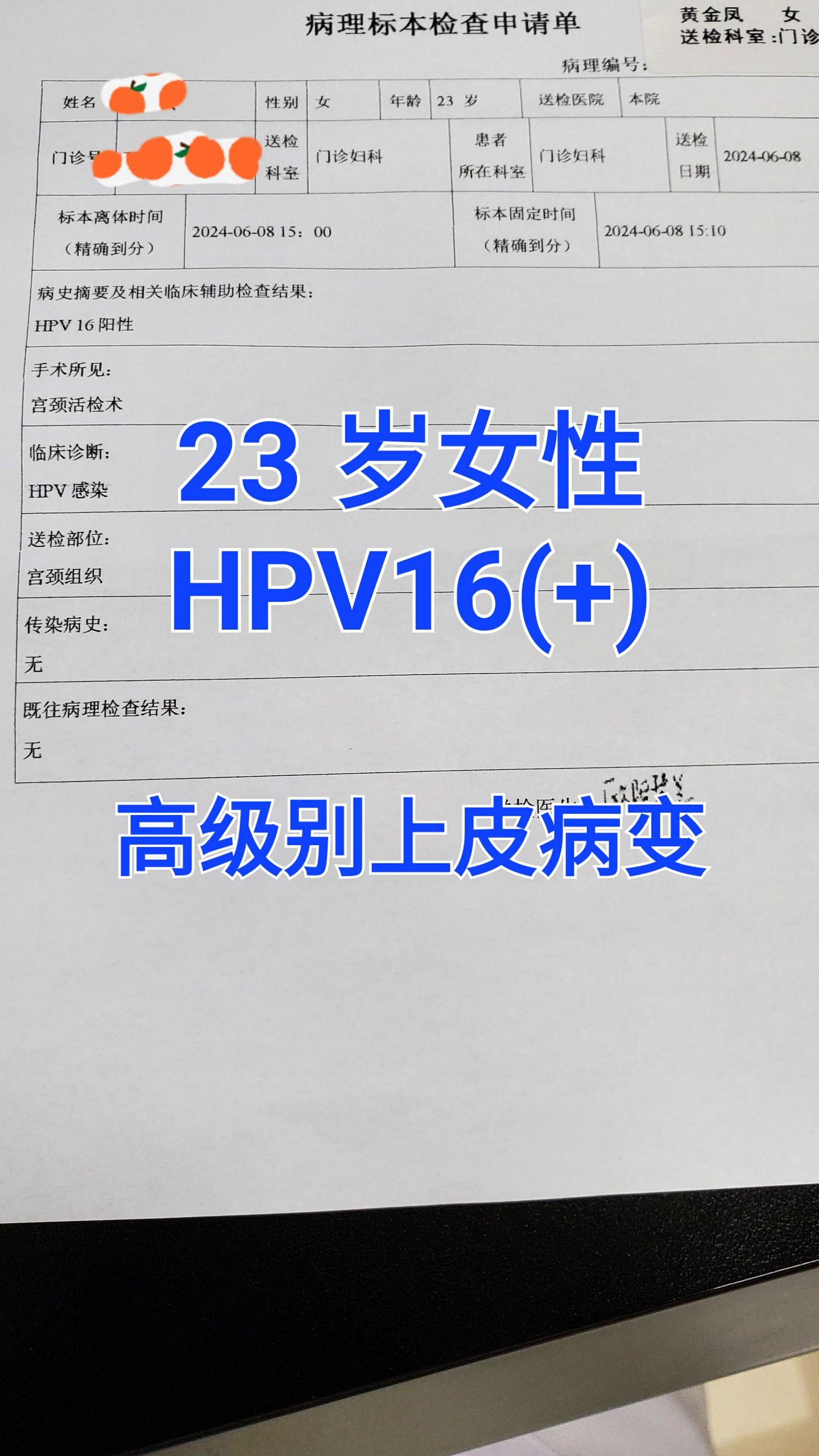 宫颈CIN3级