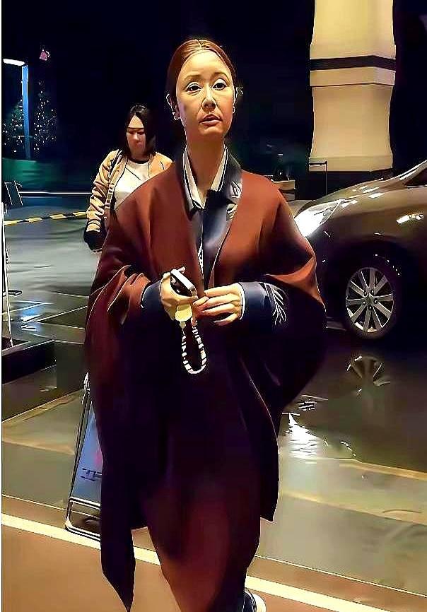 林心如49岁，脸突然“馒化”，苹果肌鼓得像俩小笼包，嘴角笑不动。网友一句“皇阿玛