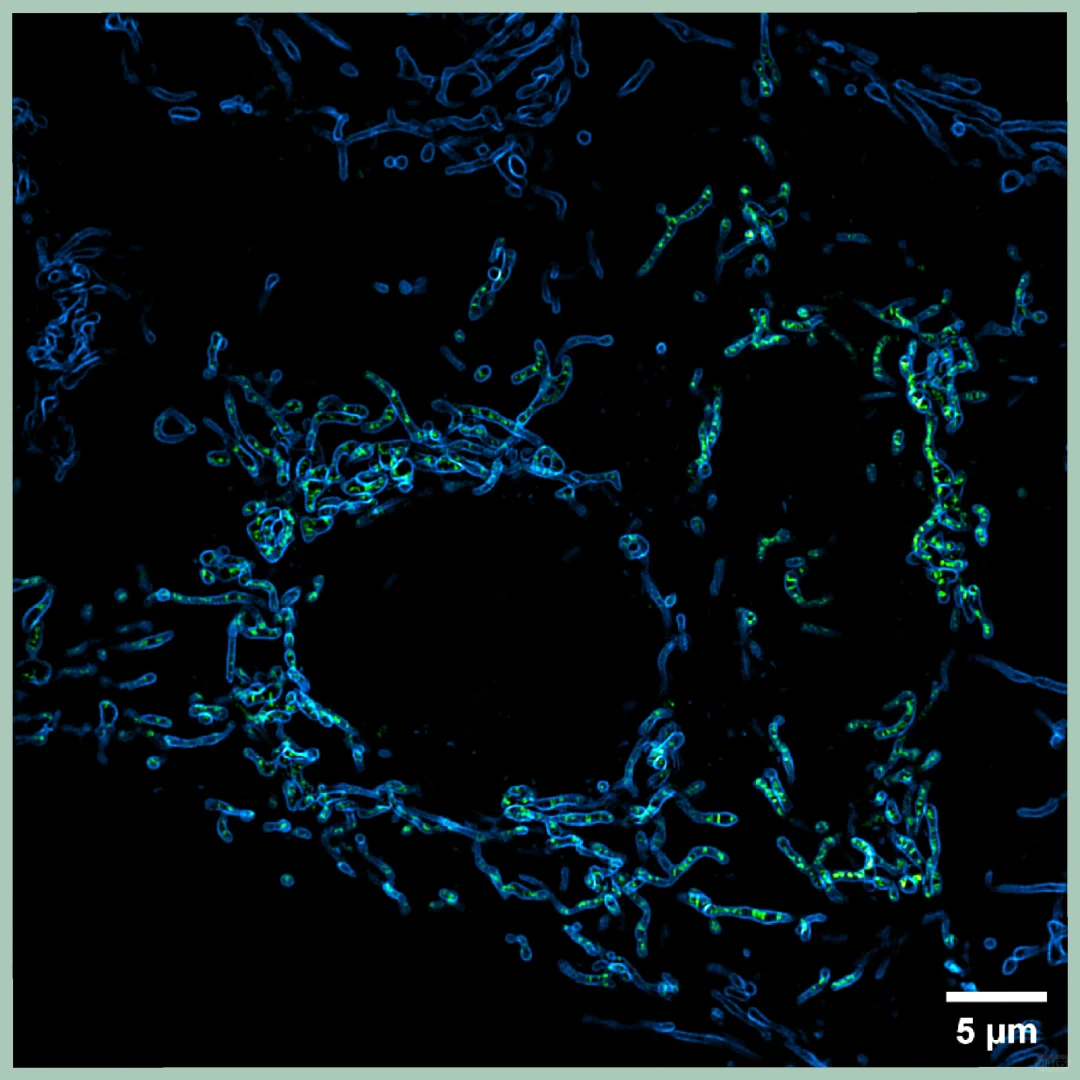 优雅！同门组会又整活，线粒体内嵴荧光质粒