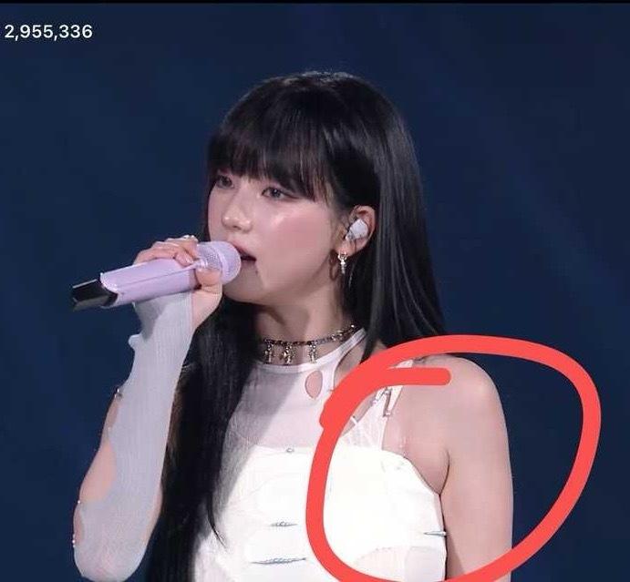 不是吸脂了吗这么又吃回来了 