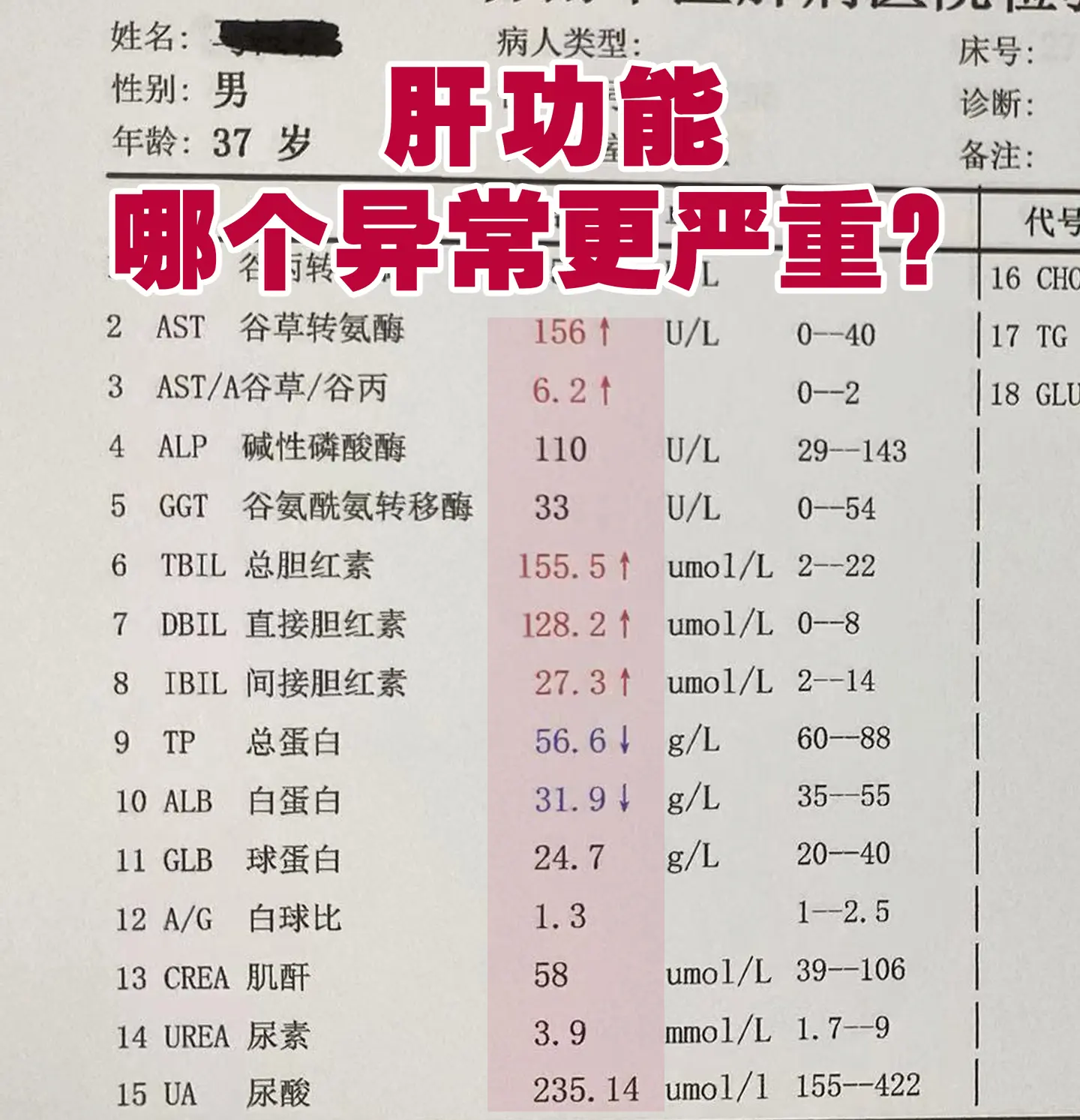 肝功能哪个异常更严重？尤其是有肝病基础的患者