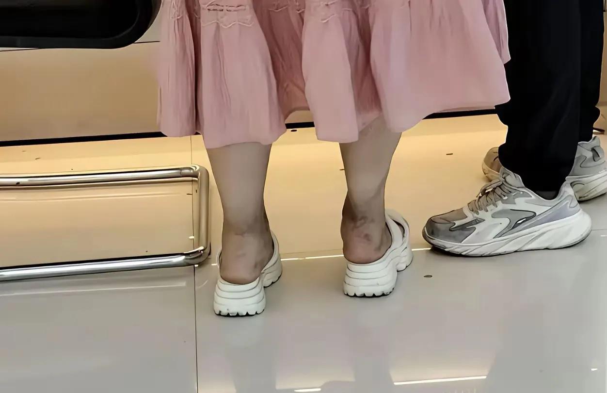街头看到这位女士属于“糖尿病足”吗？属于什么程度？严重吗？我看她很不在乎，还在大