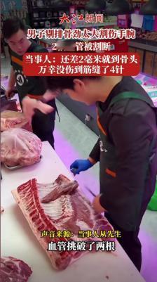 太吓人了！5月6日大象新闻报道，浙江宁波一卖肉老手剔排骨时用力过猛，剔骨刀失控直