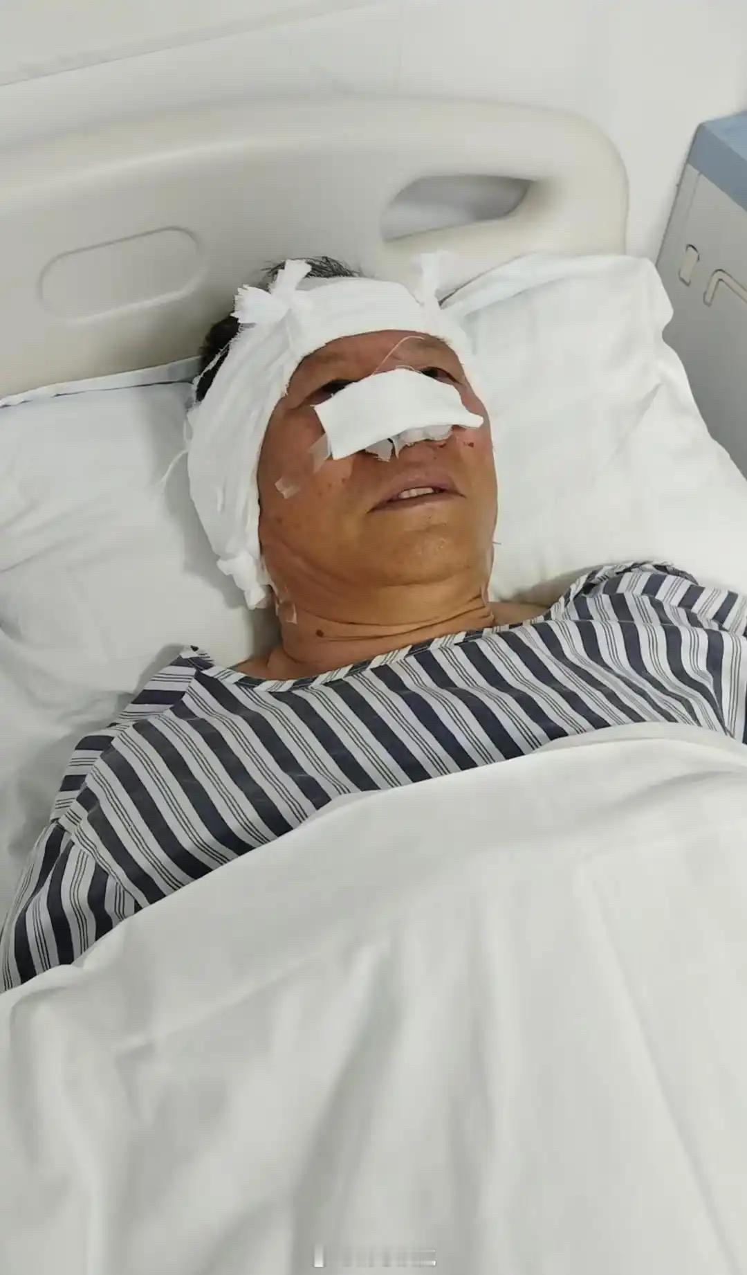 施暴者咬掉见义勇为者鼻子吞入肚中这世上有人挥拳头是为了欺负人，有人是为了保护人。