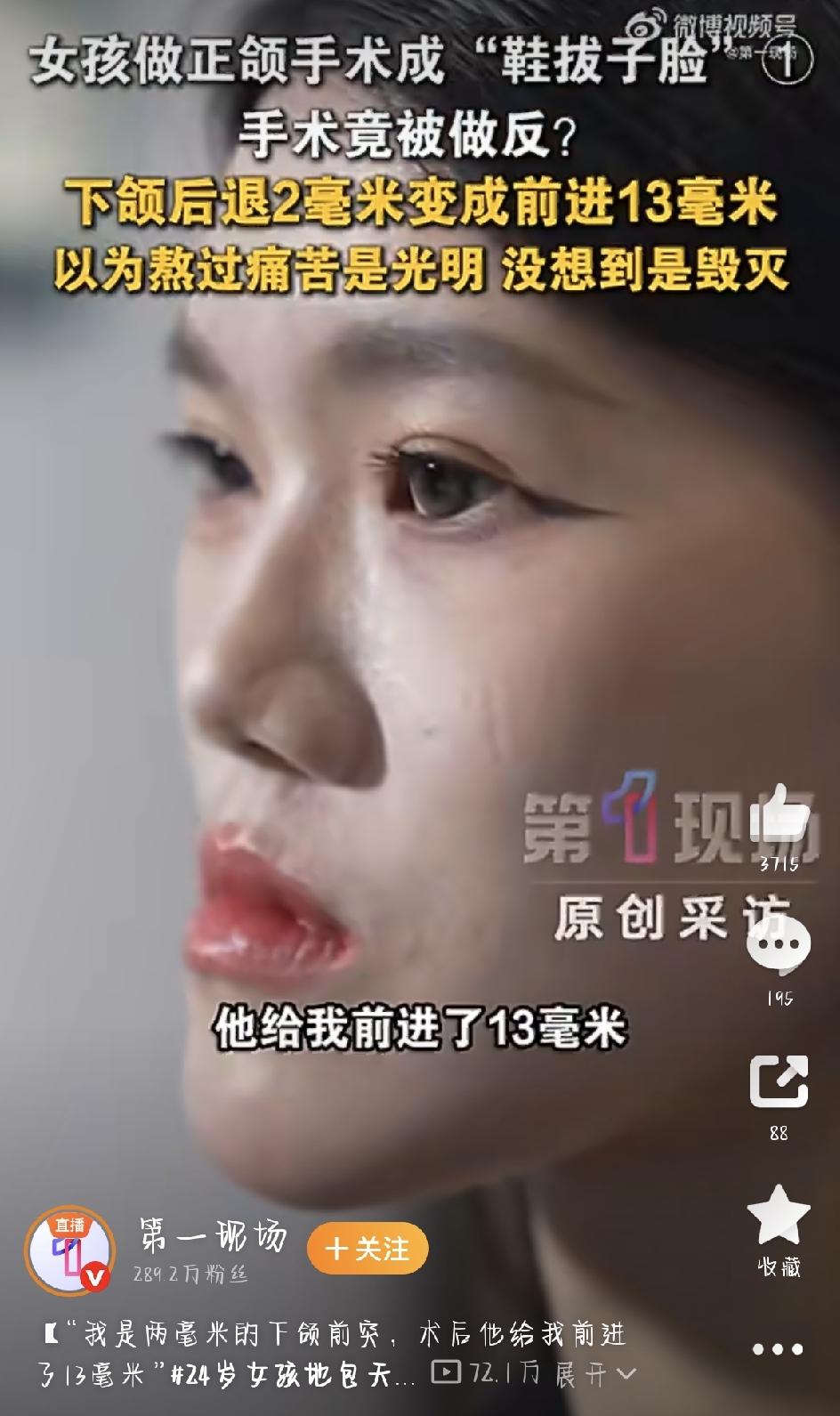 24岁女孩本想微调“地包天”，结果手术方向做反，直接变成“鞋拔子脸”——这教训太