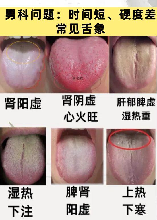 免费看舌：男人肾虚不虚，我看看舌头就知道！

应粉丝要求，今天继续帮大家看舌象！