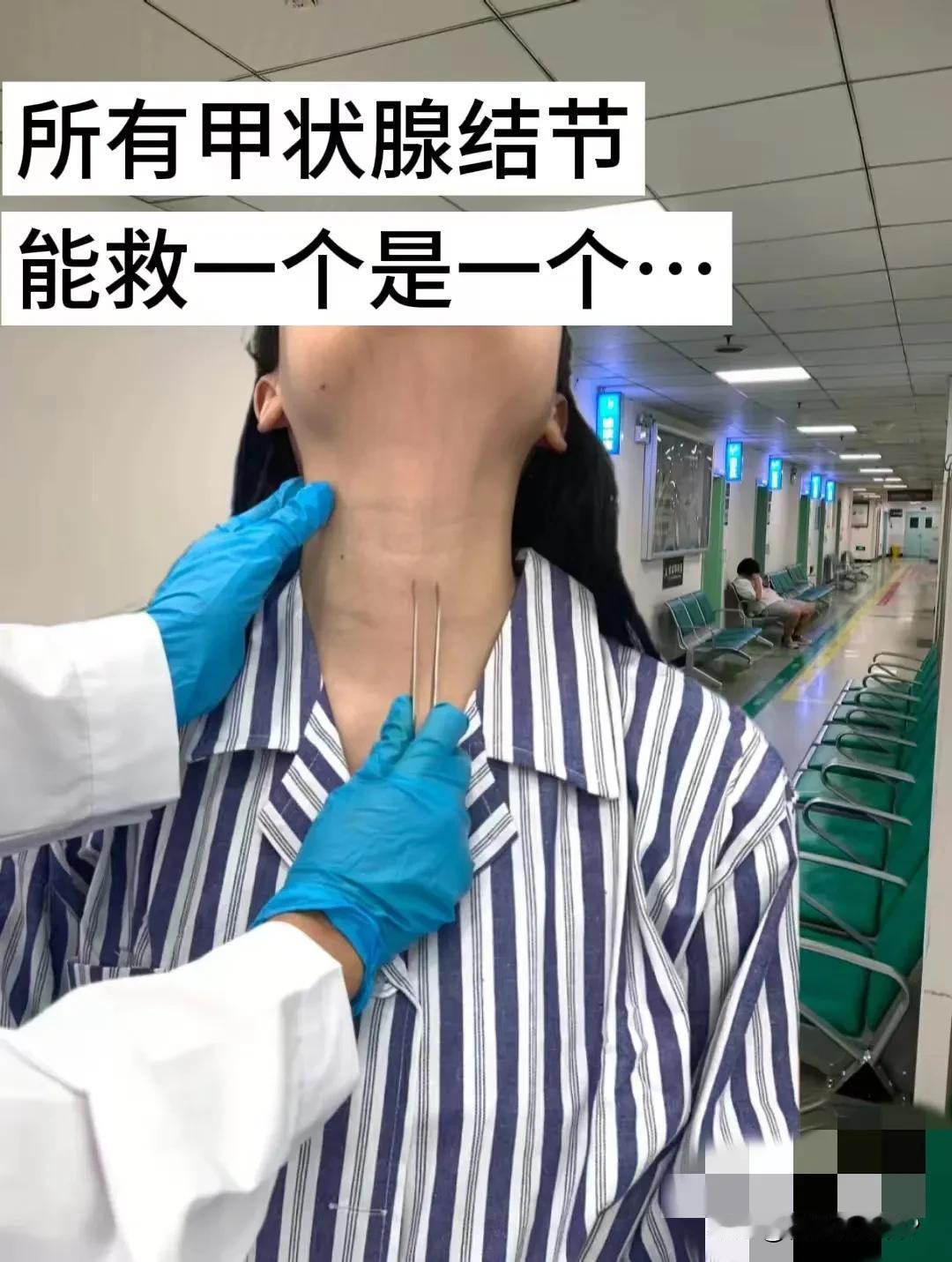 友友们，我左右两侧各查出一个甲状腺结节，平常没感觉，大声说话会疼。请问甲状腺结节