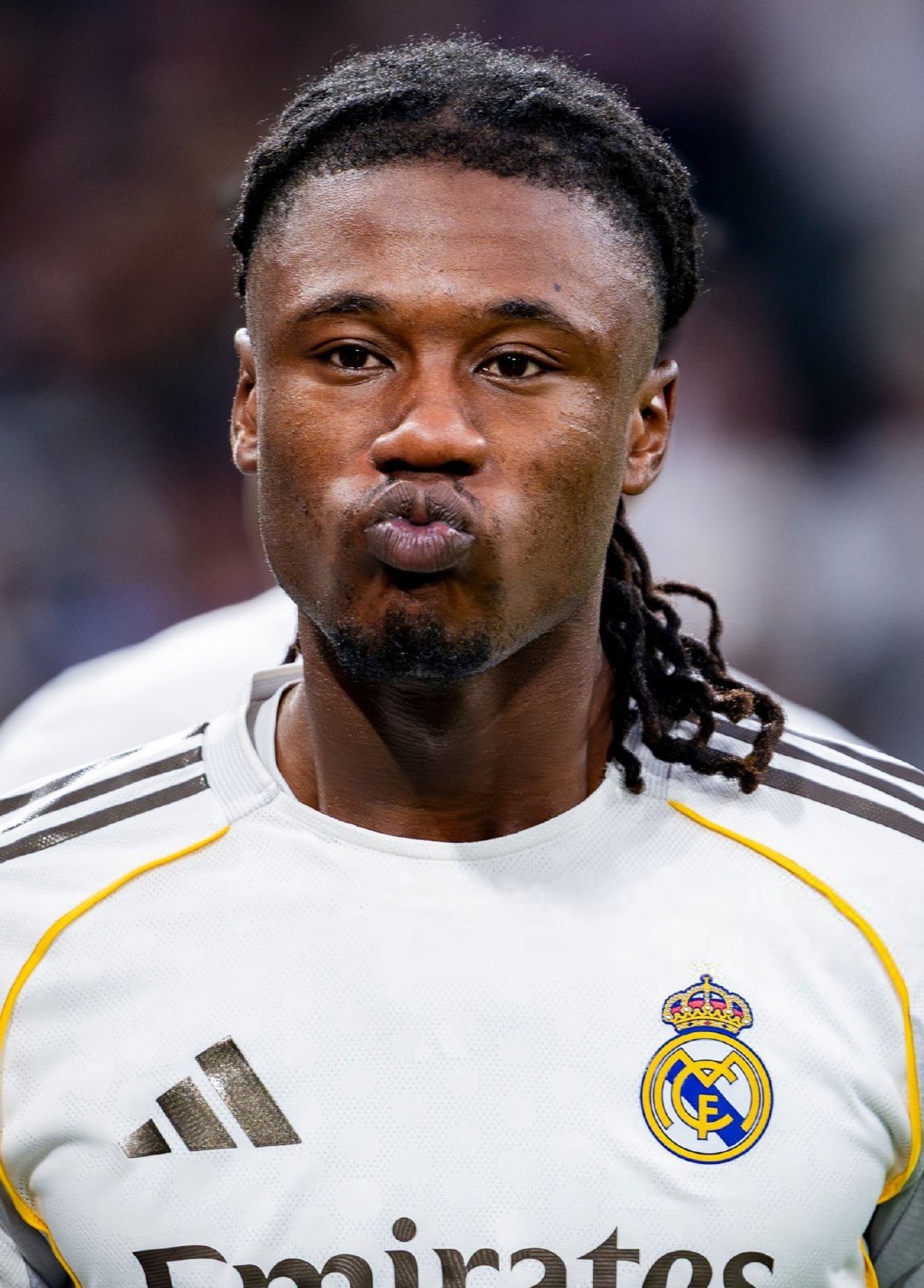 Abraham P. Romero：卡马温加仍然饱受严重的牙痛折磨。halama