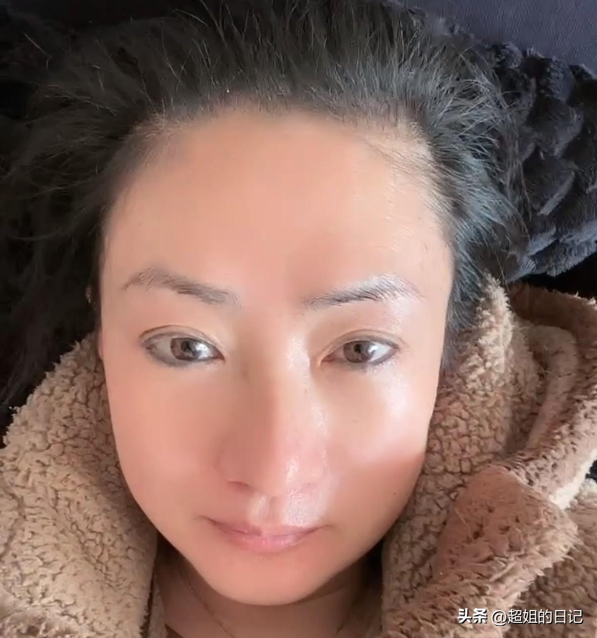 我最近胖了，胖了很多，原因就一个，焦虑症躯体化yao 导致的。

不吃药一点胃口