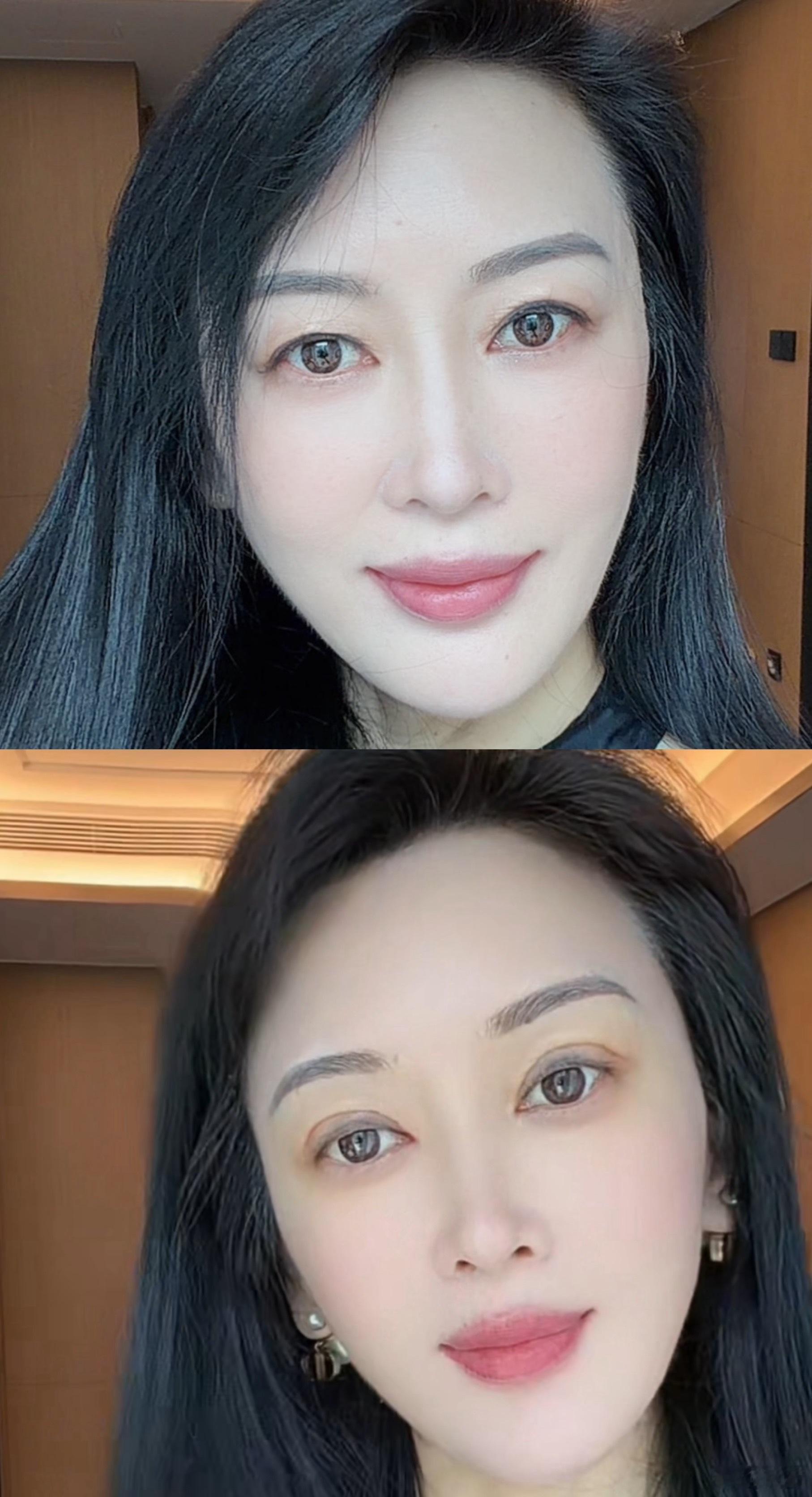 修个双眼皮换个脸的感觉，这两天都沉浸在互吹彩虹屁的快乐里，女人，就应该适时肤浅肤