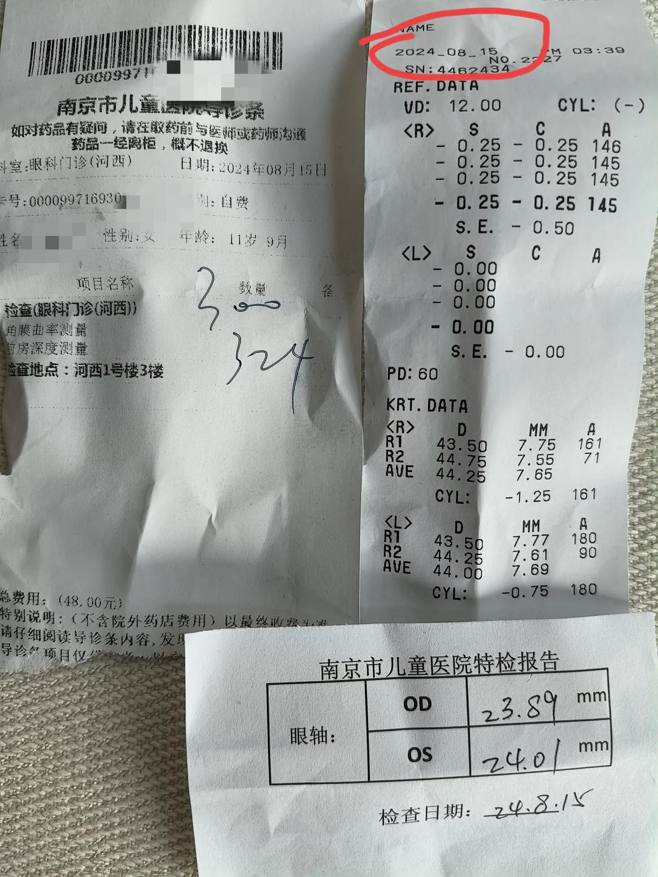 近视防控近两年，暑假狂画画和看电视，无Ok无阿托品和红光，眼轴意外又退了0.01