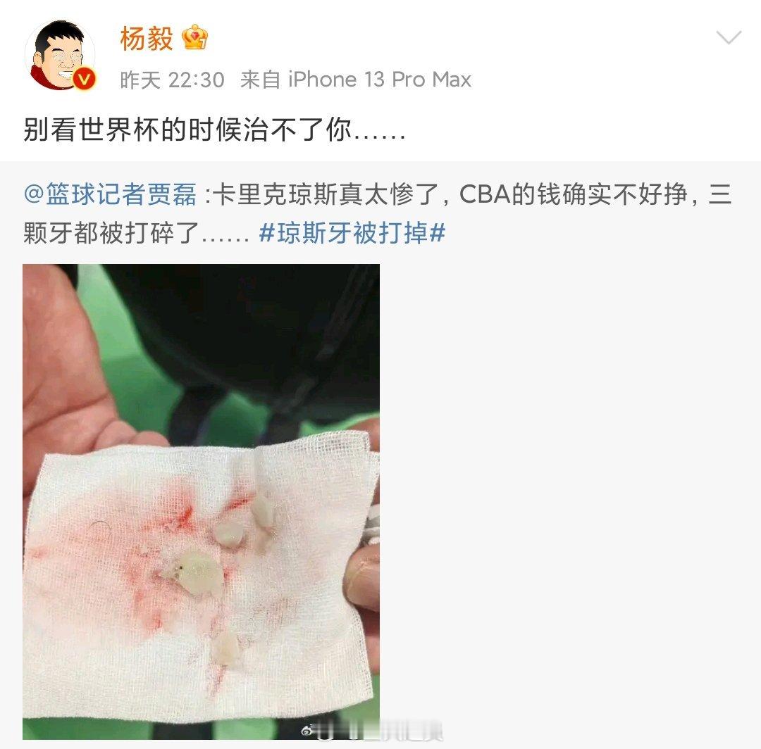 中国篮球舆论风气彻底坏掉了，煽风点火，阴阳怪气，为了流量，闻风而动，上蹿下跳，落