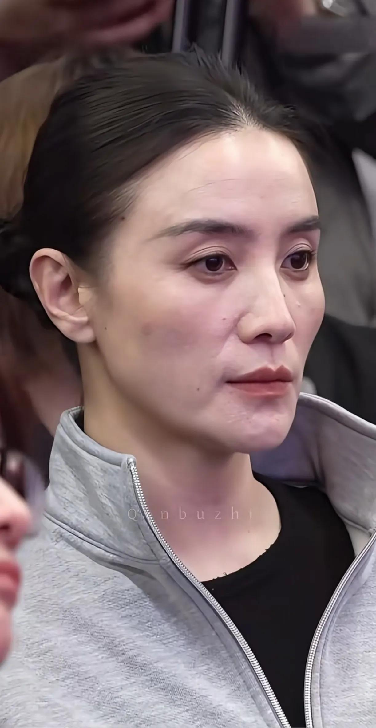 宋佳的脸越长越宽，胶原蛋白的流失，脸型长成了扁平脸。
年轻时候的宋佳，很漂亮，脸