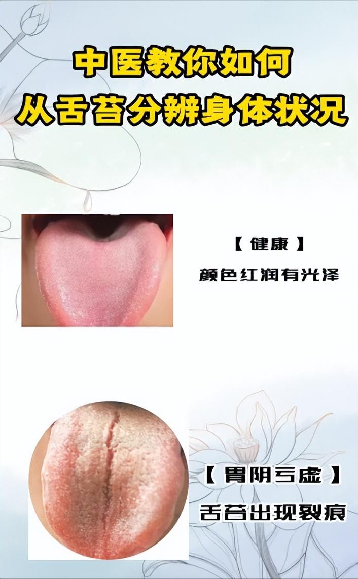 中医教你如何从舌苔分辨身体状况~