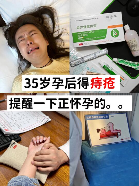 35岁孕后去痔疮｜中👩‍⚕这样提醒我