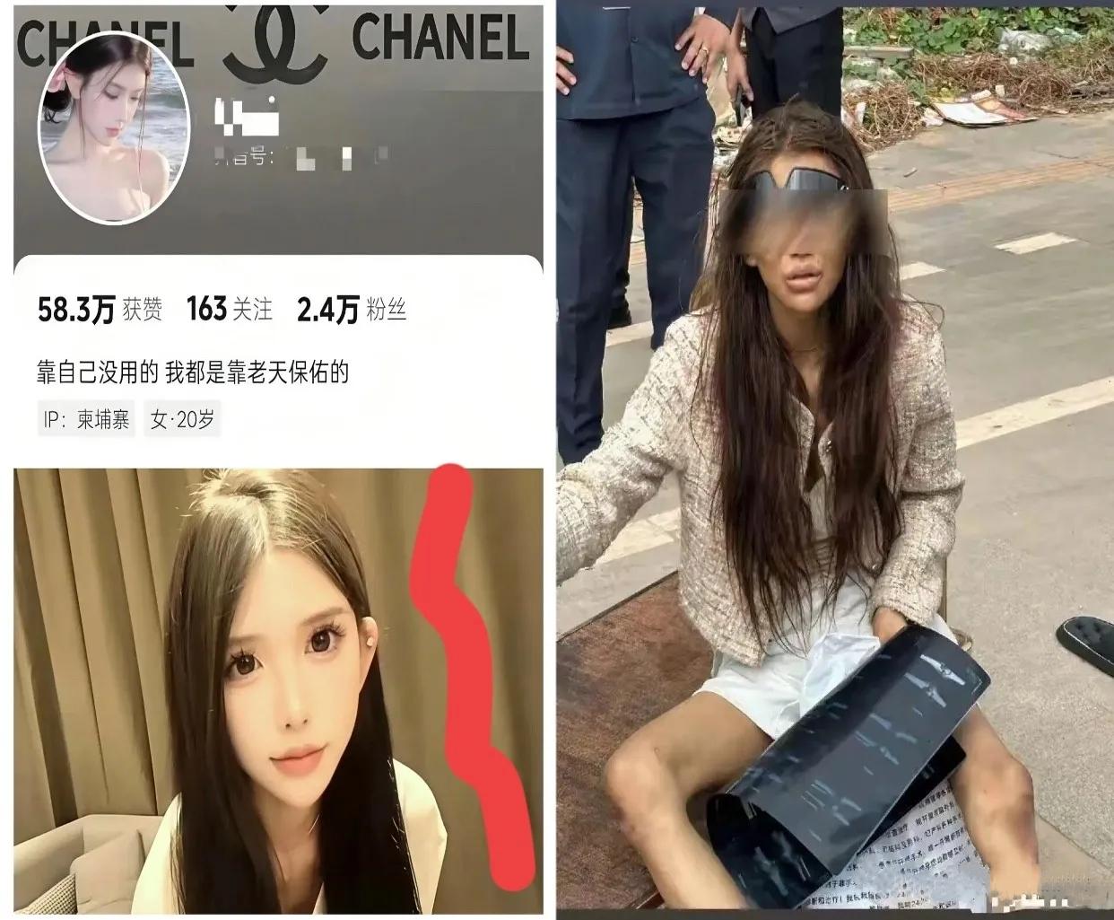 视频里她是妆容精致，笑容甜美的网红，
镜头外却衣衫褴褛，拄着拐杖流落柬埔寨街头，