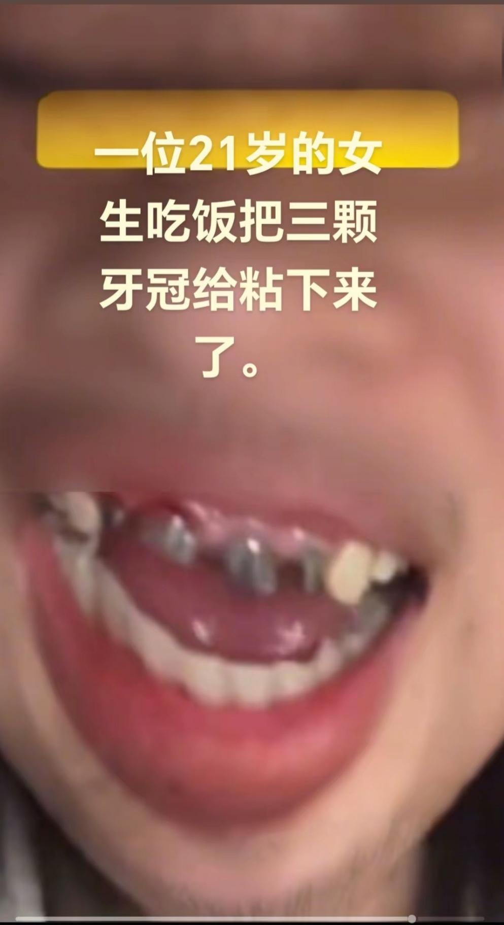 这下好了！
不仅福建知道了，
全国都知道了！

福建一年仅21岁的女生，吃个饭竟
