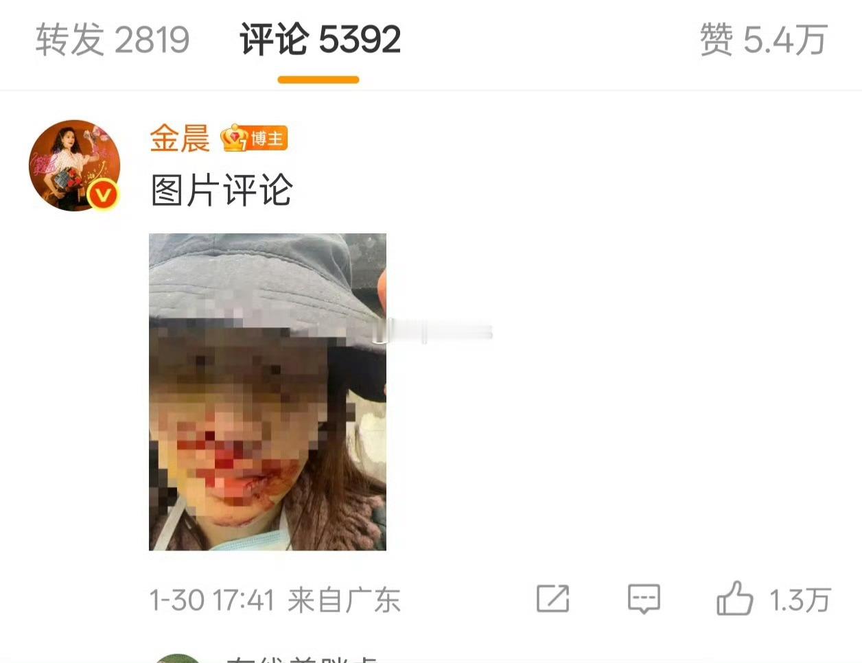 警方通报金晨事件金晨道歉了，终于回应了，没想到这张图居然是真的。金晨自己发出来的