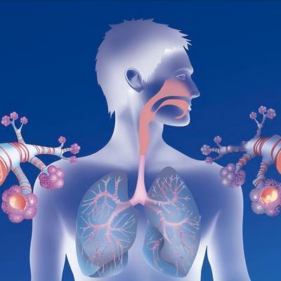 有很多人以为感染不严重，但其实它是全球第五大致死原因，为什么
最近治疗了不少肺部