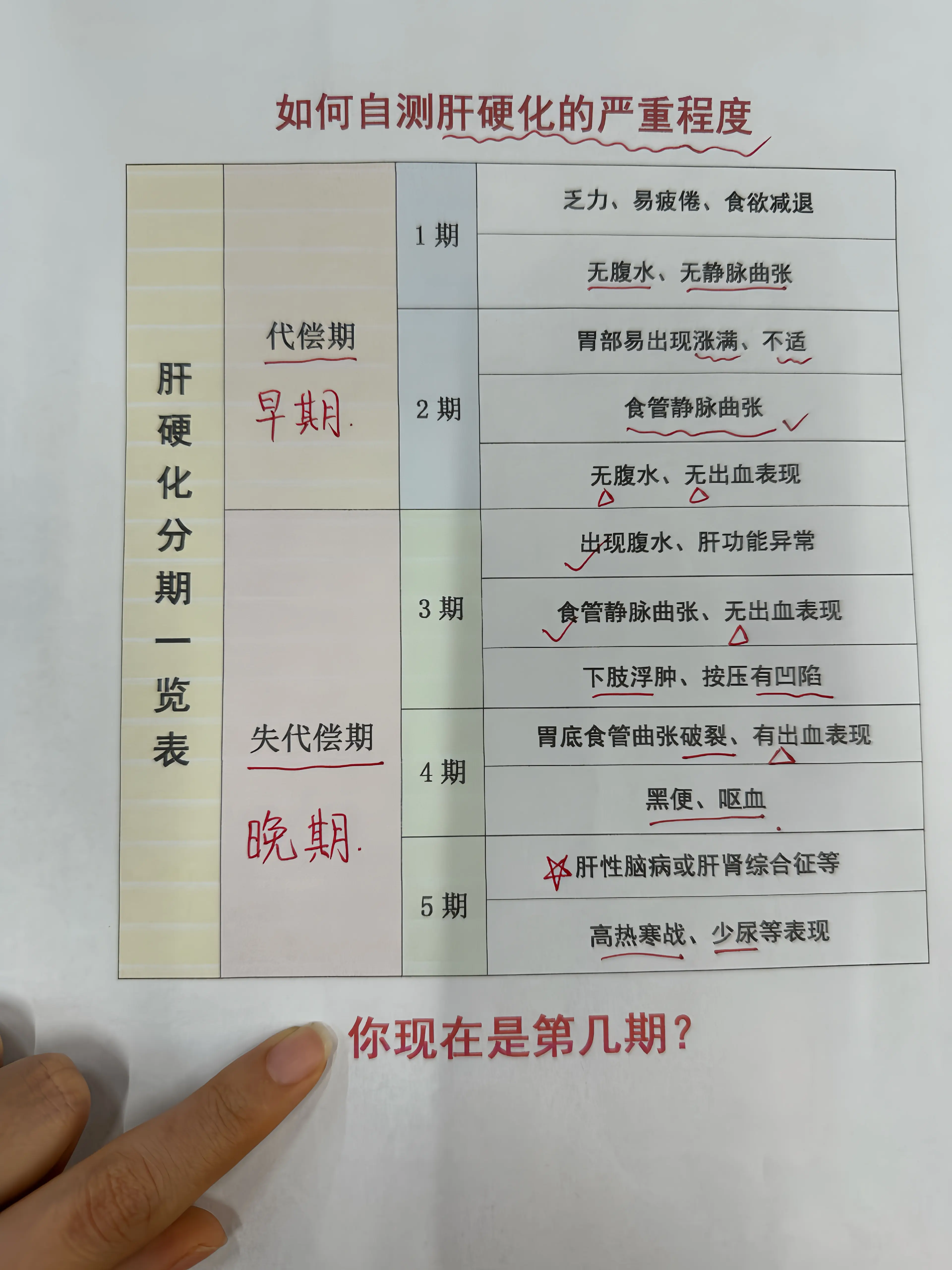 乙肝 肝硬化 腹水 消化道出血 门脉高压