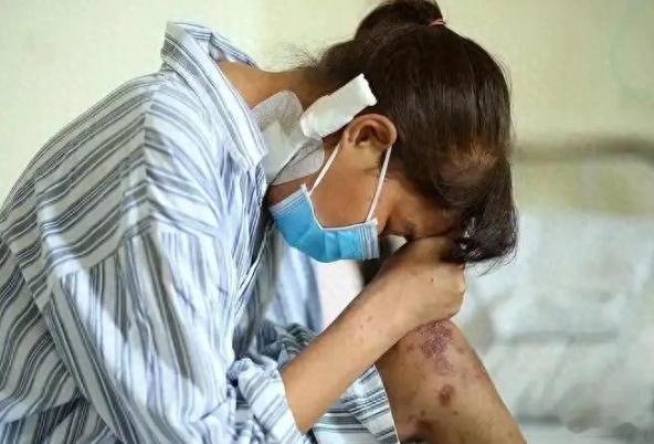 日本梅毒扩散 日本媒体5日报道，日本梅毒感染人数近年持续处于高位，确诊病例数连续