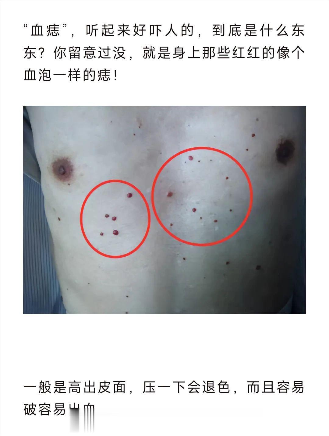 科普一下 小知识 惊不惊喜意不意外