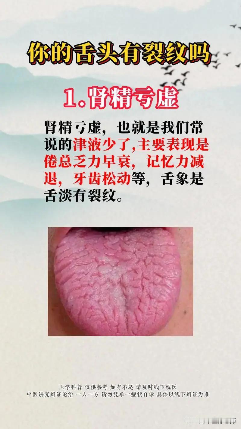 你的舌头有裂纹吗？看看你是否这样？#健康##舌裂纹##舌诊#