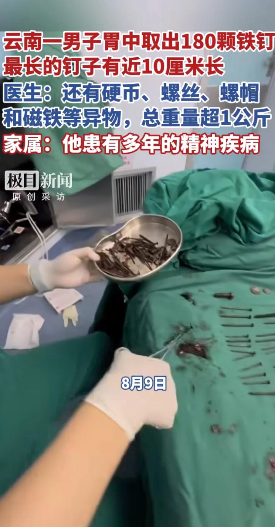 解释不清了！云南，一男子腹部剧痛送医，医生检查后当场被吓退三分：他体内居然塞满了