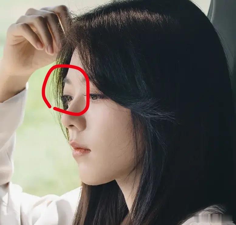 赵今麦的眼睛真的好凸到底有什么方法可以缓解 ​​​