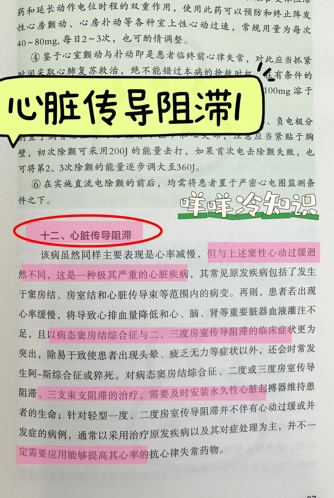 值班-心脏传导阻滞