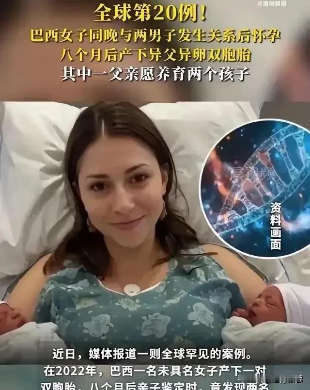 全球仅20例！巴西女子同一晚与2名男子发生了关系。不久后，女子后怀孕了，并且还生