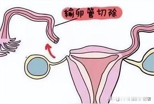 这事儿看着都心寒。
 
妻子刚做完输卵管切除手术，身体还没恢复，伤口还在疼，结果