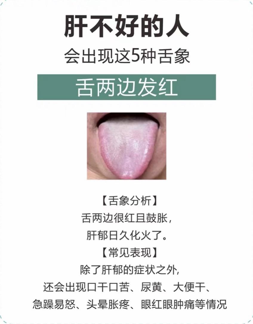 #医学科普 #舌苔辨证 #科普一下 #调理身体