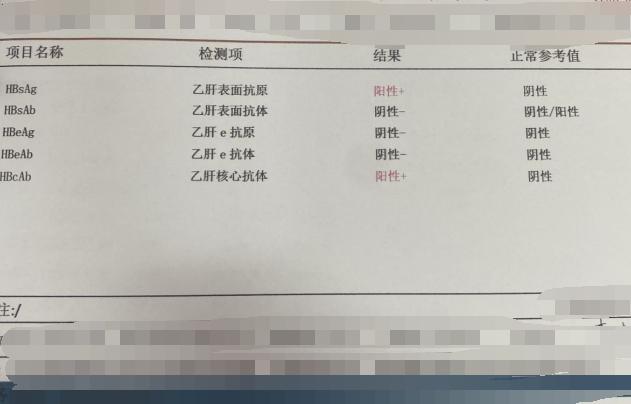 大三阳转小二阳，病毒量小于50，接下来怎么办？ 
有位粉丝朋友问我：“主任你好，我今年29岁，有乙肝家族史，之前一直没有治疗过，两年前因为身体不适，恶心、口苦、乏力等到医院检查，谷丙转氨酶偏高，大三阳，在医生的建议下开始服用的抗病毒药，吃的是恩替卡韦，和一些中成药，最近到医院做了一次检查，目前是小二阳，病毒DNA也小于50，请问我接下来该怎么办”？ 
【回复】根据这位朋友，抗病毒治疗2年，乙肝大三阳转为小二阳，出现了e抗原的消失，之后可能会转为小三阳，如果能够转成小三阳，是病情稳定的表现，这点不需要担心，另
