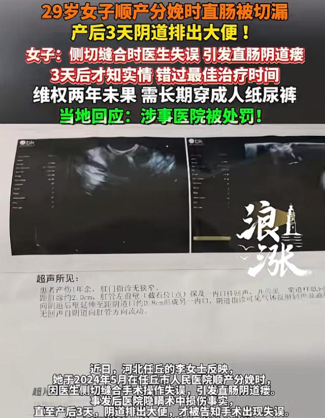 “太坑人了”河北任丘，29女子岁在某医院顺产生娃，3天后，突然在阴道里排出大便，