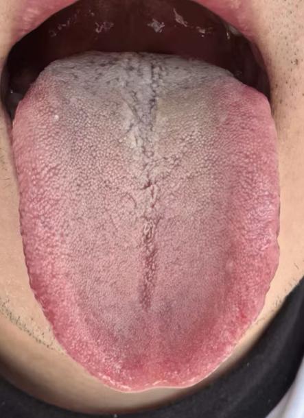 海绵体状态不佳？试试温阳通络，双向调理更管用






有不少朋友一出现海绵体