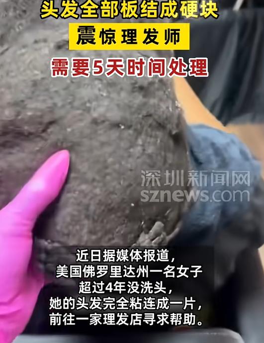 “真是活久见！”8月4日报道，美国，一女子超过4年没洗头，她的头发完全粘连成一片