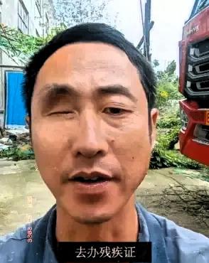一只眼睛没了，去办残疾证，工作人员说办不了，因为你另一只眼好使，不影响正常生活。