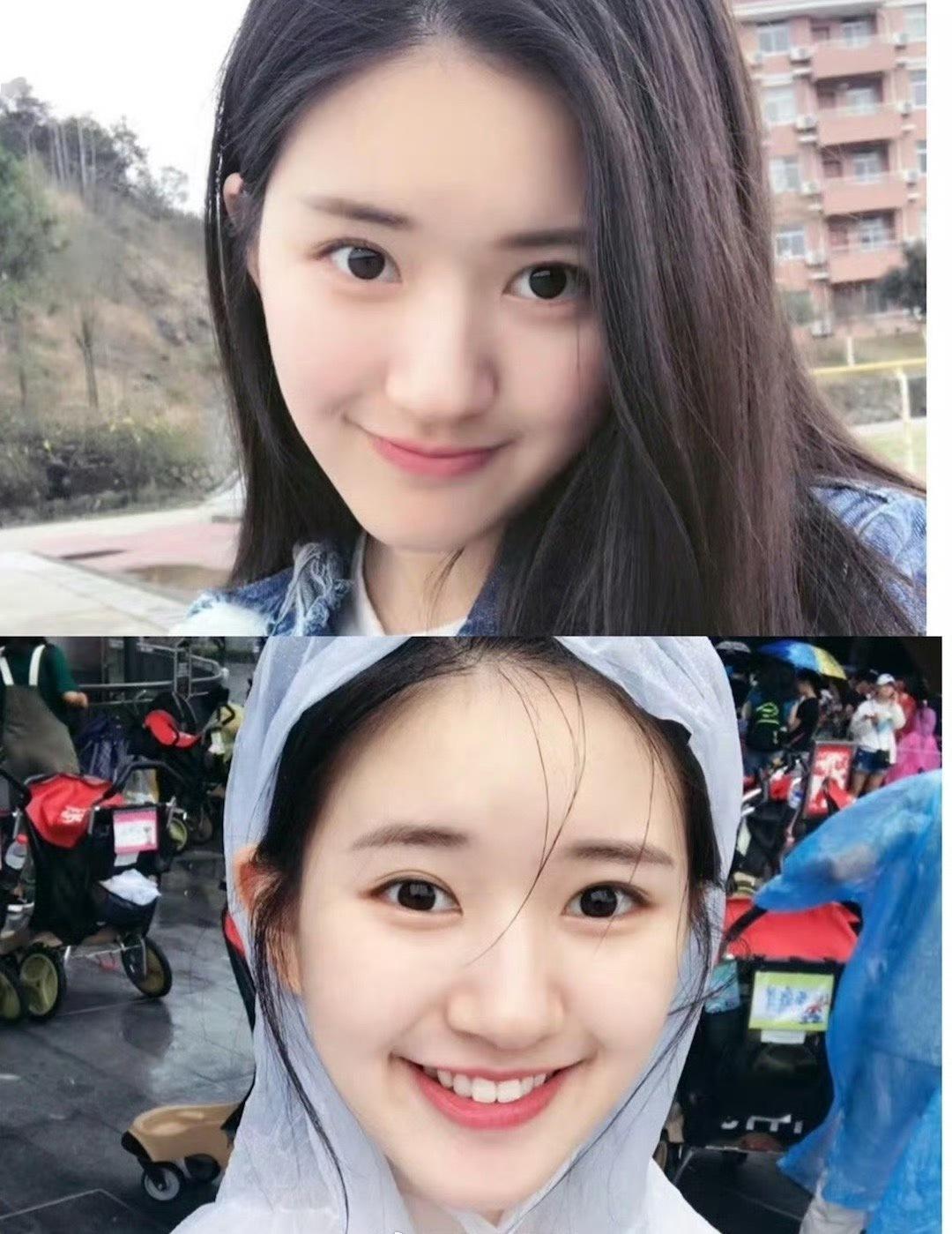 赵露思是我觉得最可惜的一个女孩 ，原先的面相多好，福气满满的元气少女…… ​​​