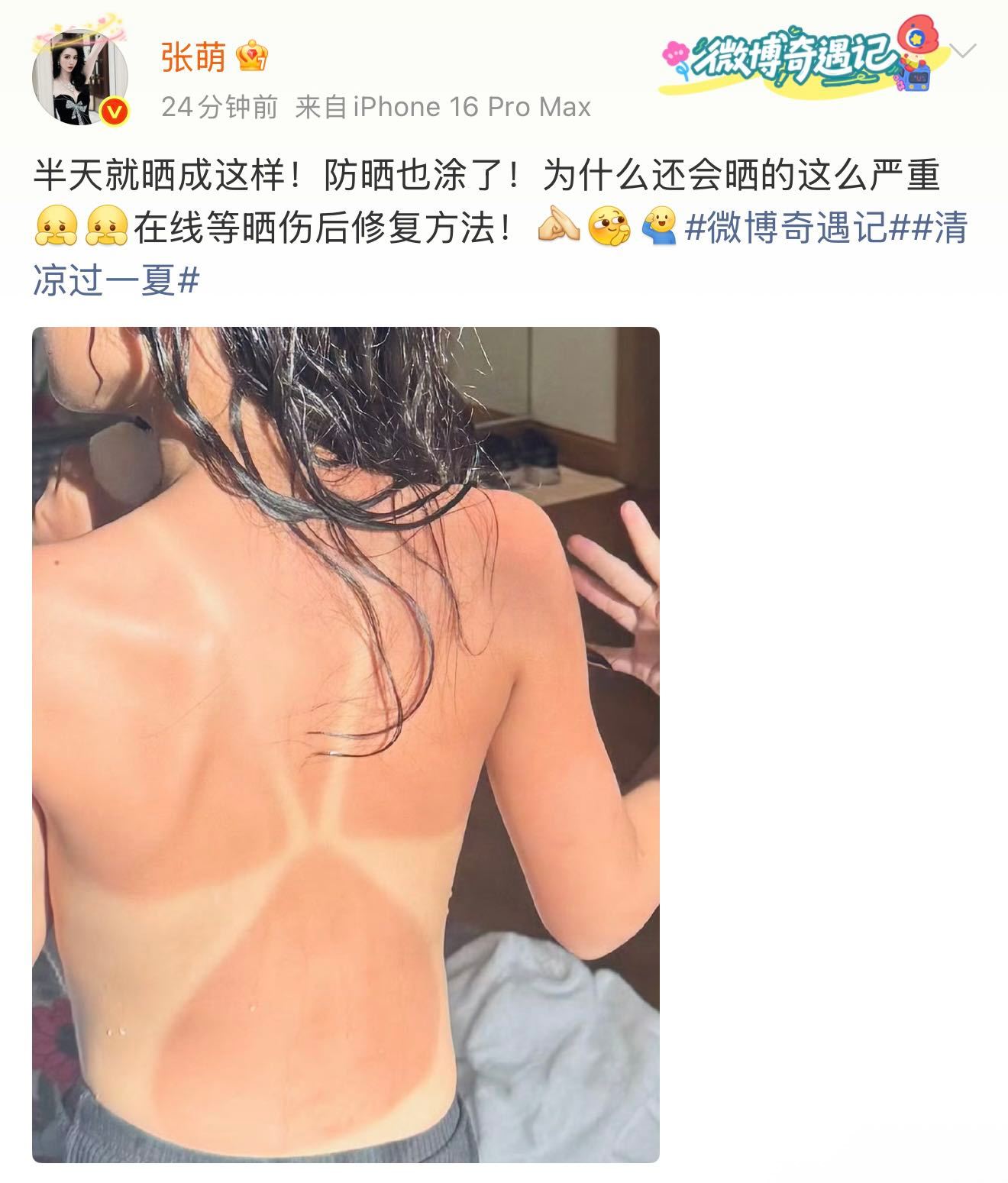 张萌在线求晒伤修复方法 这晒伤是什么情况？目测起来有点严重啊！姐上线急求晒伤后的