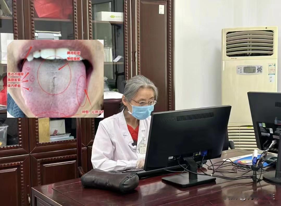 这种舌象，不要上来就疏肝健脾补肾阳了，少了这一步，做什么都白搭

患者主诉两胁胀