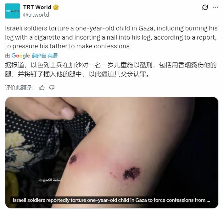 禽兽不如！
据土耳其国家公共广播公司：以色列士兵在加沙对一名一岁儿童施以酷刑，包