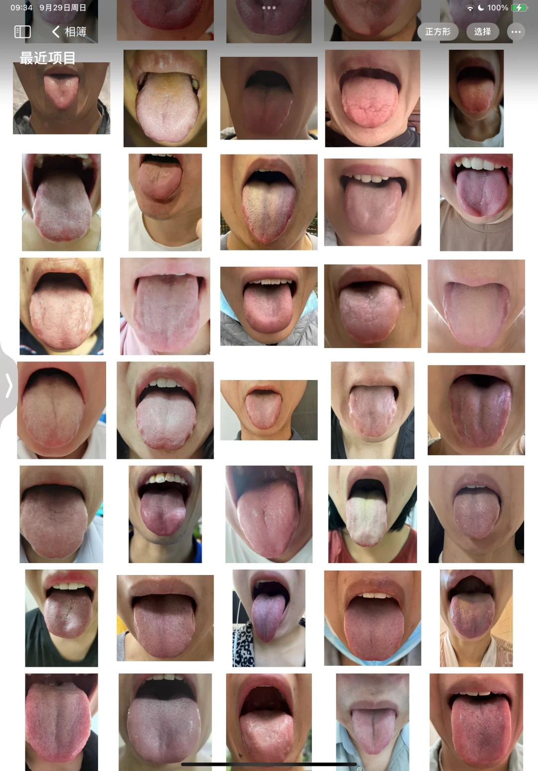 猜猜看哪个舌头是我的