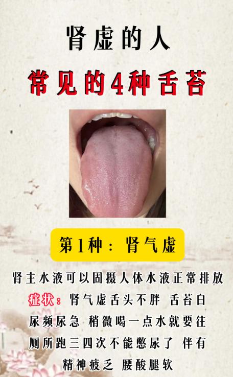 肾气不足看舌苔：这 4 种表现要留意