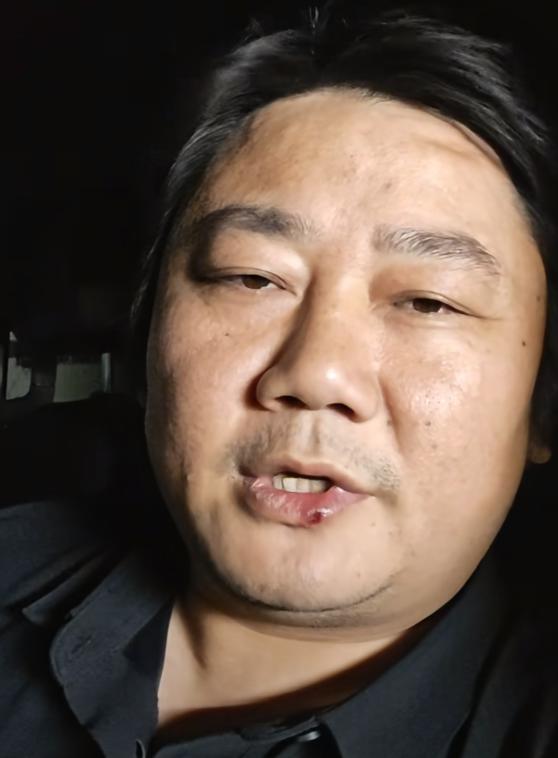 张雪这次发声，我觉得有个细节挺有意思。
昨天凌晨，他针对韩红基金会救护车采购争议