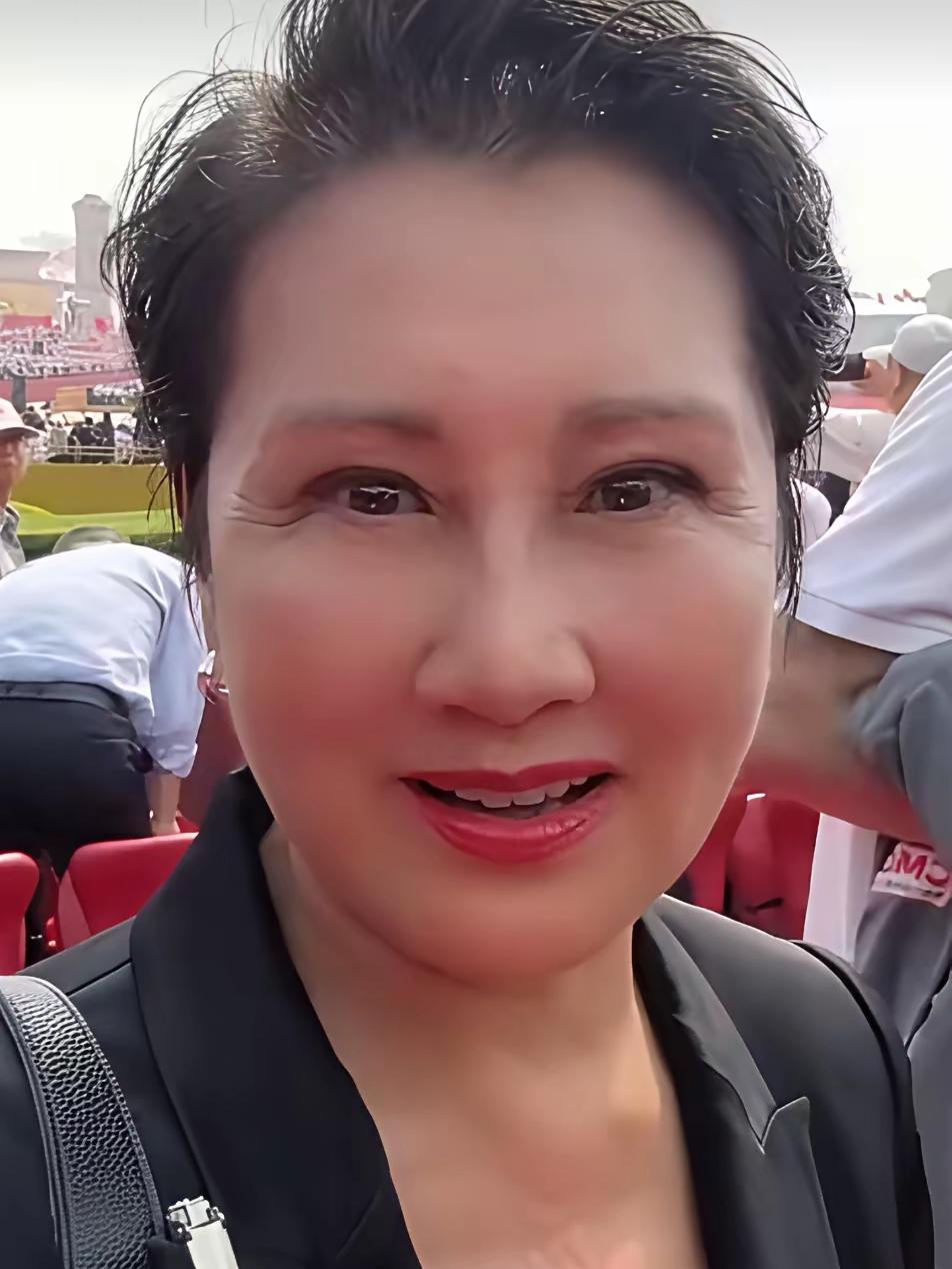 看张凯丽，尽管脸颊光滑细腻，可眼周却布满深深的皱纹，使得整张脸看上去颇为怪异。