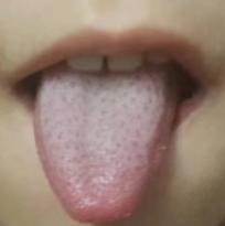 脾胃好了，孩子吃饭香了，手脚不凉了，嘴里没味了，3个月长了3.5cm！
 
这是