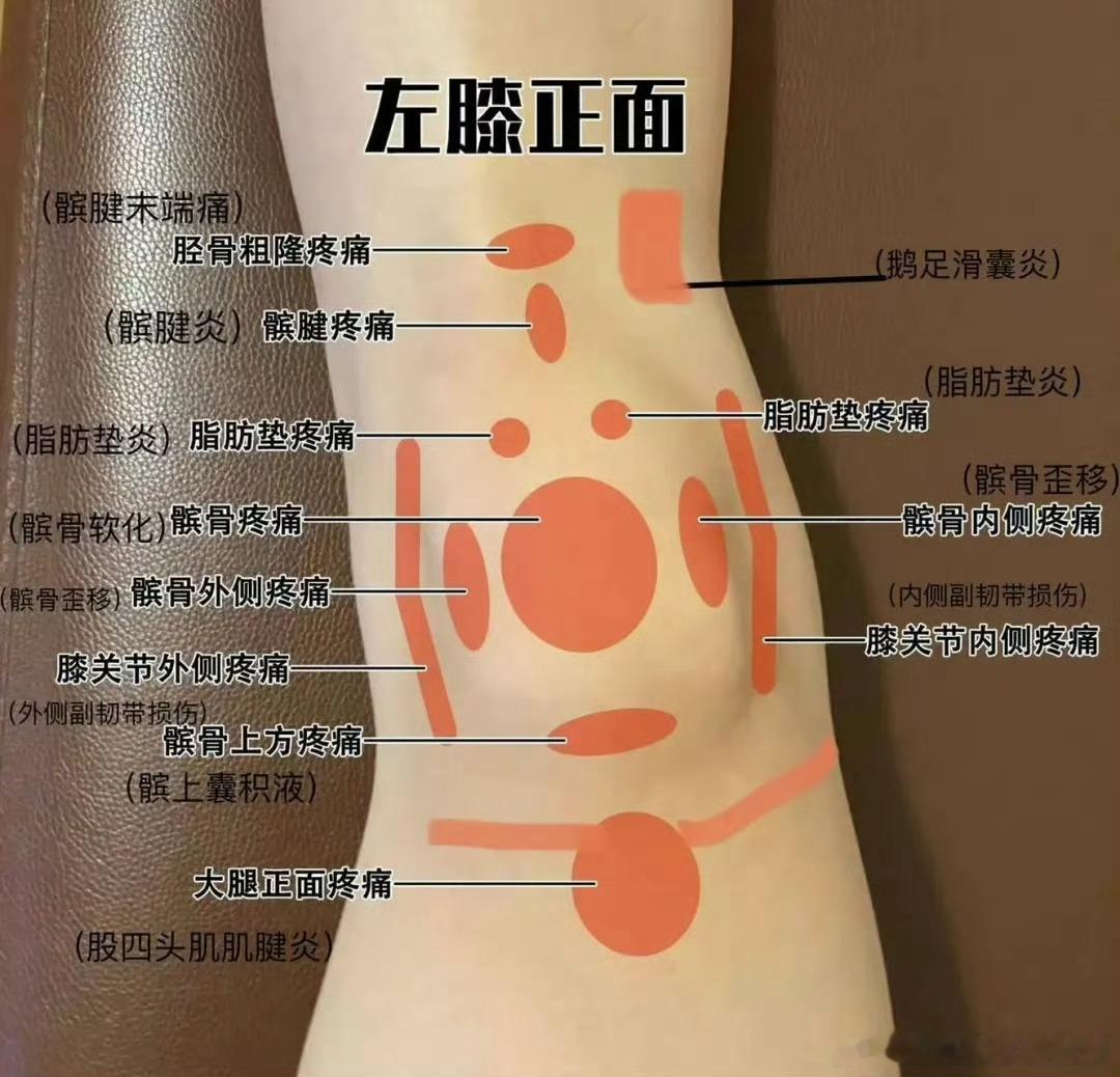 #半月板损伤# 【半月板部分摘除VS缝合】德约科维奇在今年6月的法网比赛中膝盖受