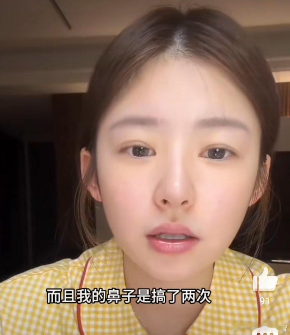 黄一鸣自曝整容失败对这人无感，但是说实话，她整的很自然，刚开始还以为原生的呢，她